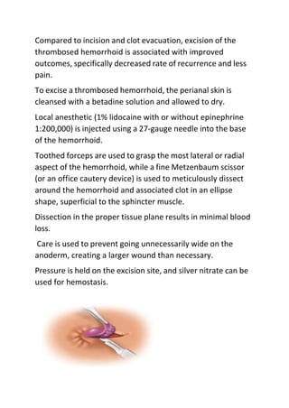 Compared to incision and clot evacuation, excision of the
thrombosed hemorrhoid is associated with improved
outcomes, specifically decreased rate of recurrence and less
pain.
To excise a thrombosed hemorrhoid, the perianal skin is
cleansed with a betadine solution and allowed to dry.
Local anesthetic (1% lidocaine with or without epinephrine
1:200,000) is injected using a 27-gauge needle into the base
of the hemorrhoid.
Toothed forceps are used to grasp the most lateral or radial
aspect of the hemorrhoid, while a fine Metzenbaum scissor
(or an office cautery device) is used to meticulously dissect
around the hemorrhoid and associated clot in an ellipse
shape, superficial to the sphincter muscle.
Dissection in the proper tissue plane results in minimal blood
loss.
Care is used to prevent going unnecessarily wide on the
anoderm, creating a larger wound than necessary.
Pressure is held on the excision site, and silver nitrate can be
used for hemostasis.
 