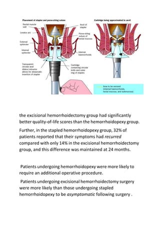 the excisional hemorrhoidectomy group had significantly
better quality-of-life scores than the hemorrhoidopexy group.
Further, in the stapled hemorrhoidopexy group, 32% of
patients reported that their symptoms had recurred
compared with only 14% in the excisional hemorrhoidectomy
group, and this difference was maintained at 24 months.
Patients undergoing hemorrhoidopexy were more likely to
require an additional operative procedure.
Patients undergoing excisional hemorrhoidectomy surgery
were more likely than those undergoing stapled
hemorrhoidopexy to be asymptomatic following surgery .
 