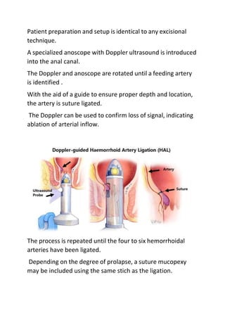 Patient preparation and setup is identical to any excisional
technique.
A specialized anoscope with Doppler ultrasound is introduced
into the anal canal.
The Doppler and anoscope are rotated until a feeding artery
is identified .
With the aid of a guide to ensure proper depth and location,
the artery is suture ligated.
The Doppler can be used to confirm loss of signal, indicating
ablation of arterial inflow.
The process is repeated until the four to six hemorrhoidal
arteries have been ligated.
Depending on the degree of prolapse, a suture mucopexy
may be included using the same stich as the ligation.
 