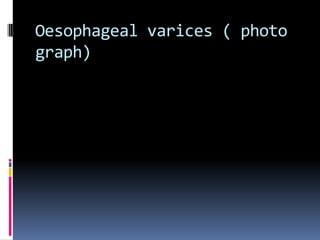 Oesophageal varices ( photo
graph)
 
