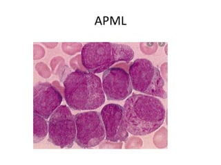 Haematological emergencies | PPTX