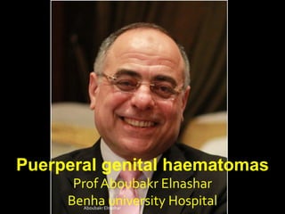 Puerperal genital haematomas
Prof Aboubakr Elnashar
Benha university HospitalAboubakr Elnashar
 