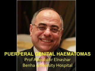 PUERPERAL GENITAL HAEMATOMAS
Prof Aboubakr Elnashar
Benha university Hospital
 