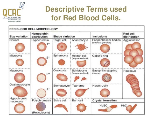 Haematopathology: Introducing The Various Types Of Anaemias And Red… - 638x479 - jpeg Abnormal Red Blood Cell Size