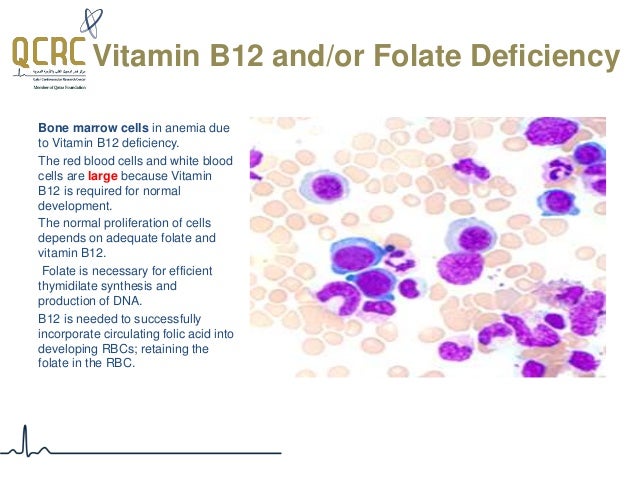 Haematopathology: Introducing The Various Types Of Anaemias And Red… - 638x479 - jpeg B12 Deficiency Bone Scan