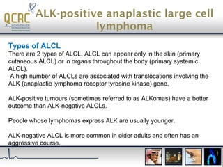 Haematopathology: an introduction to lymphoid neoplasms | PPT