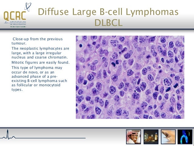 Haematopathology an introduction to lymphoid neoplasms