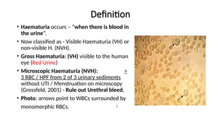 Presence of Blood in Urine or HAEMATURIA.pptx