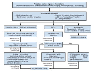 Haematuria management new