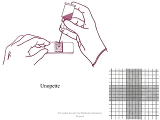 Unopette
17
Sri Lanka Society for Medical Laboratory
Science
 