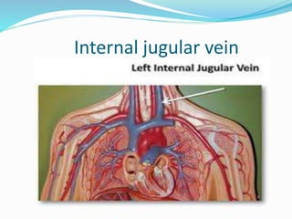 Internal jugular vein 
 
