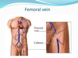 Femoral vein 
 