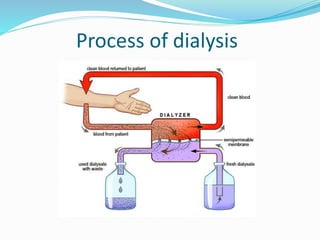 Process of dialysis 
 