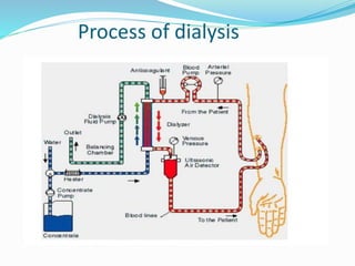 Process of dialysis 
 