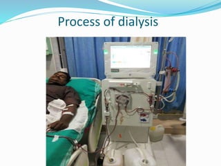 Process of dialysis 
 