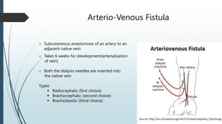 haemodialysis-170422111605.pptx.............. | PPTX