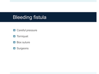 Bleeding fistula
 Careful pressure
 Torniquet
 Box suture
 Surgeons
 