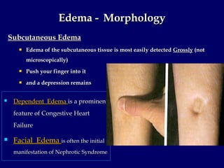 Haemodynamic disorders , thromboembolism and shock by Dr Nadeem (RMC) | PPT