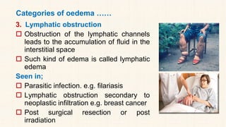 Categories of oedema ……
3. Lymphatic obstruction
 Obstruction of the lymphatic channels
leads to the accumulation of fluid in the
interstitial space
 Such kind of edema is called lymphatic
edema
Seen in;
 Parasitic infection. e.g. filariasis
 Lymphatic obstruction secondary to
neoplastic infiltration e.g. breast cancer
 Post surgical resection or post
irradiation
 