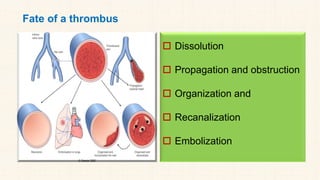 Fate of a thrombus
 Dissolution
 Propagation and obstruction
 Organization and
 Recanalization
 Embolization
 