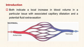 Introduction
 Both indicate a local increase in blood volume in a
particular issue with associated capillary dilatation and a
potential fluid extravasation
 