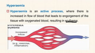 Hyperaemia
 Hyperaemia is an active process, where there is
increased in flow of blood that leads to engorgement of the
tissue with oxygenated blood, resulting in erythema.
 