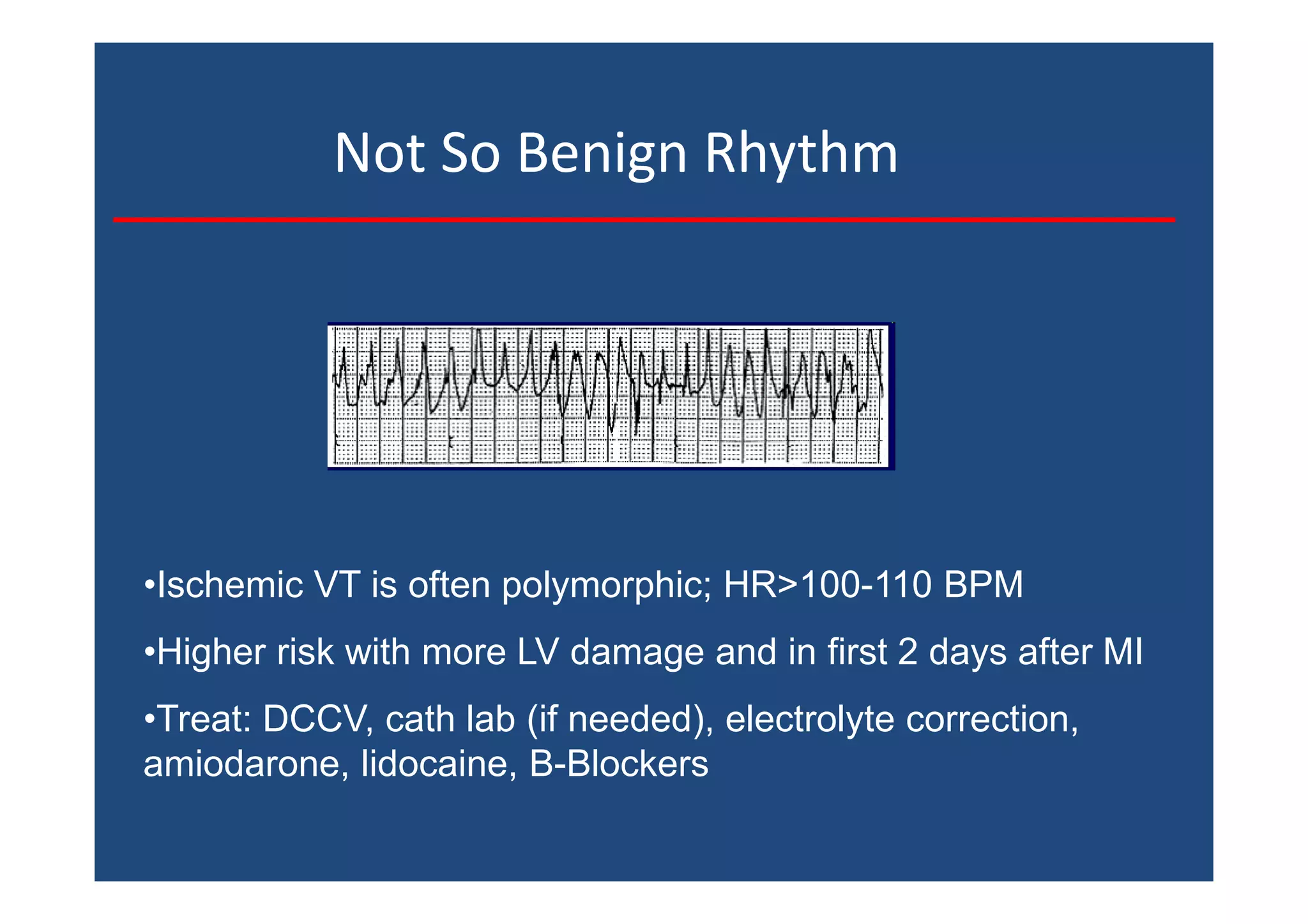 Not So Benign Rhythm
•Ischemic VT is often polymorphic; HR>100-110 BPM
•Higher risk with more LV damage and in first 2 days after MI
•Treat: DCCV, cath lab (if needed), electrolyte correction,
amiodarone, lidocaine, B-Blockers
 
