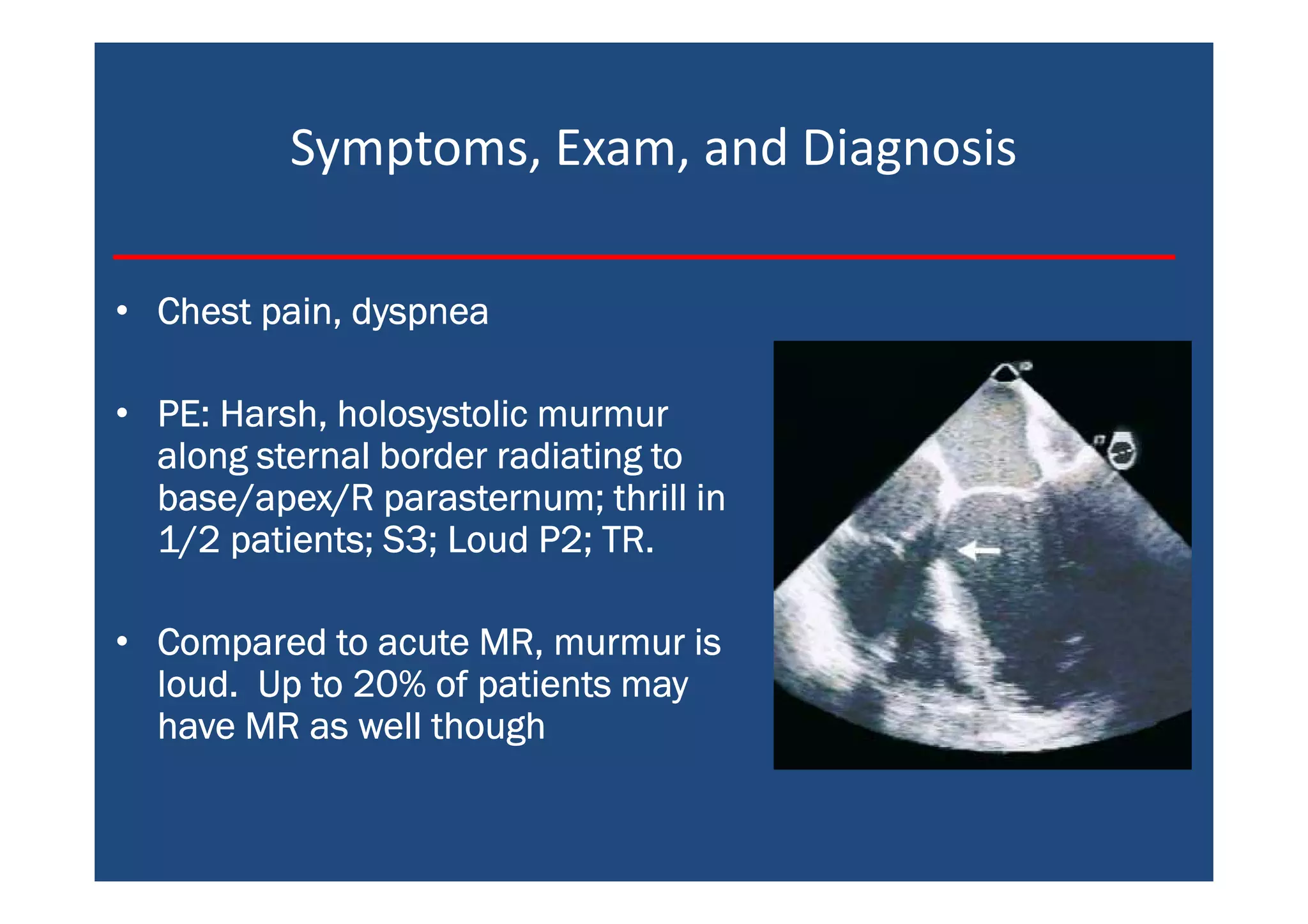 Symptoms, Exam, and Diagnosis
• Chest pain, dyspneaChest pain, dyspneaChest pain, dyspneaChest pain, dyspnea
• PE: Harsh, holosystolic murmurPE: Harsh, holosystolic murmurPE: Harsh, holosystolic murmurPE: Harsh, holosystolic murmur
along sternal border radiating toalong sternal border radiating toalong sternal border radiating toalong sternal border radiating to
base/apex/R parasternum; thrill inbase/apex/R parasternum; thrill inbase/apex/R parasternum; thrill inbase/apex/R parasternum; thrill in
1/2 patients; S3; Loud P2; TR.1/2 patients; S3; Loud P2; TR.1/2 patients; S3; Loud P2; TR.1/2 patients; S3; Loud P2; TR.
• Compared to acute MR, murmur isCompared to acute MR, murmur isCompared to acute MR, murmur isCompared to acute MR, murmur is
loud. Up to 20% of patients mayloud. Up to 20% of patients mayloud. Up to 20% of patients mayloud. Up to 20% of patients may
have MR as well thoughhave MR as well thoughhave MR as well thoughhave MR as well though
 