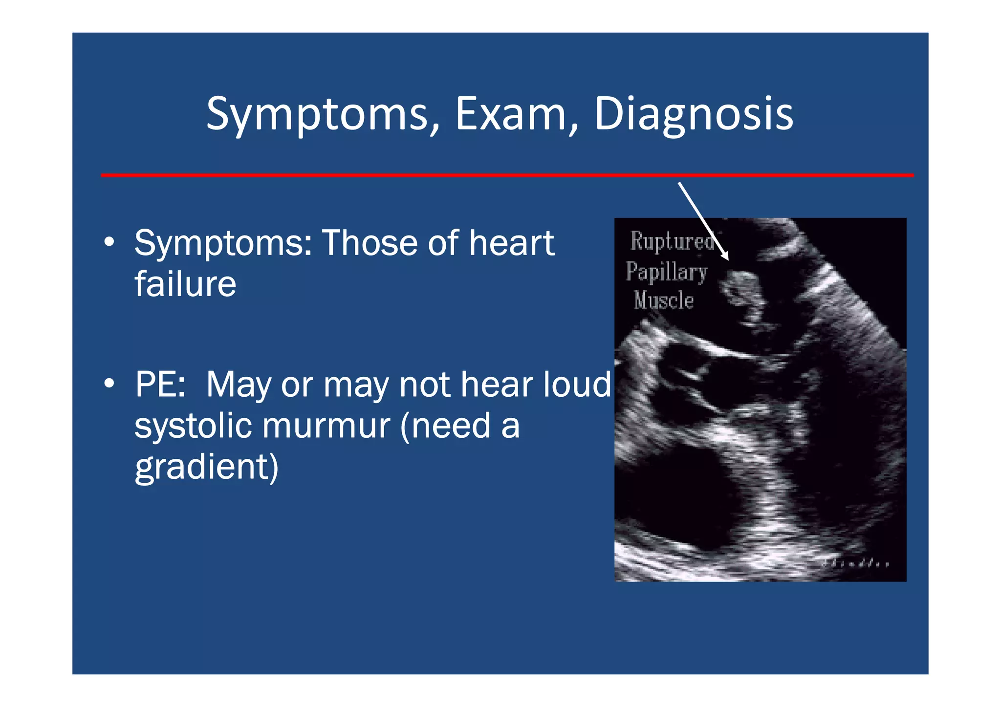 Symptoms, Exam, Diagnosis
• Symptoms: Those of heartSymptoms: Those of heartSymptoms: Those of heartSymptoms: Those of heart
failurefailurefailurefailure
• PE: May or may not hear loudPE: May or may not hear loudPE: May or may not hear loudPE: May or may not hear loud
systolic murmur (need asystolic murmur (need asystolic murmur (need asystolic murmur (need a
gradient)gradient)gradient)gradient)
 