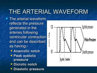 Haemodynamic monitoring | PPT