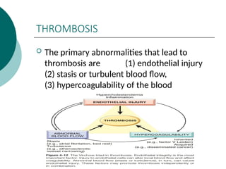 THROMBOSIS
 The primary abnormalities that lead to
thrombosis are (1) endothelial injury
(2) stasis or turbulent blood flow,
(3) hypercoagulability of the blood
 