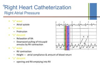 HEMODYNAMICS PRINCIPLES -PRESSURE MEASUREMENT -MEASUREMENT OF CARDIAC ...