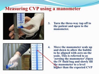3. Turn the three-way tap off to
the patient and open to the
manometer.
4. Move the manometer scale up
and down to allow the bubble
to be aligned with zero on the
scale. This is referred to as
'zeroing the manometer'.Open
the IV fluid bag and slowly fill
the manometer to a level
higher than the expected CVP
Measuring CVP using a manometer
 