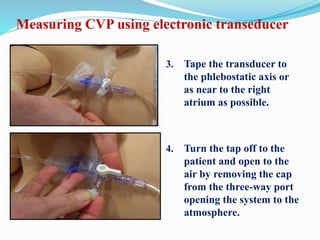 3. Tape the transducer to
the phlebostatic axis or
as near to the right
atrium as possible.
4. Turn the tap off to the
patient and open to the
air by removing the cap
from the three-way port
opening the system to the
atmosphere.
Measuring CVP using electronic transeducer
 