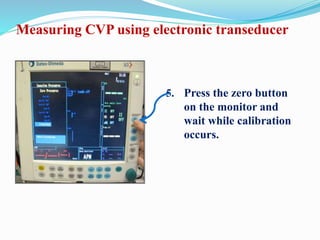 5. Press the zero button
on the monitor and
wait while calibration
occurs.
Measuring CVP using electronic transeducer
 