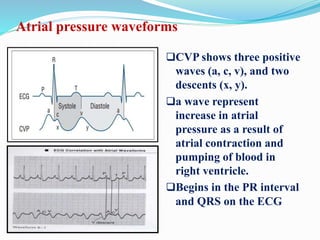 Atrial pressure waveforms
CVP shows three positive
waves (a, c, v), and two
descents (x, y).
a wave represent
increase in atrial
pressure as a result of
atrial contraction and
pumping of blood in
right ventricle.
Begins in the PR interval
and QRS on the ECG
 