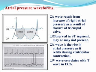 Atrial pressure waveforms
c wave result from
increase of right atrial
pressure as a result of
closure of tricuspid
valve.
Observed in ST segment,
may or may not present.
v wave is the rise in
atrial pressure as it
refills during ventricular
contraction.
V wave correlates with T
wave in ECG.
 