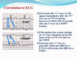 Correlation to ECG
First locate the “v” wave. It will
appear immediately after the “T”
wave on a CVP waveform,
however, it will be .08-.12 seconds
after the T wave on a PAWP
tracing.
If the patient has a sinus rhythm,
an “a” wave should be in the PR
interval for a CVP. It is later in
the PAWP.
If present, the “c” wave is
generally within the QRS for a
CVP. It will be after the QRS for a
PAWP .
 