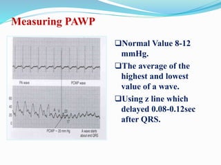 Normal Value 8-12
mmHg.
The average of the
highest and lowest
value of a wave.
Using z line which
delayed 0.08-0.12sec
after QRS.
Measuring PAWP
 
