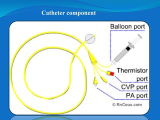 Catheter component
 