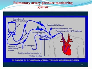 Pulmonary artery pressure monitoring
system
 