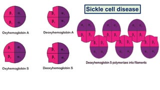 Sickle cell disease
 