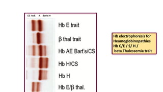 Hb electrophoresis for
Heamoglobinopathies
Hb C/E / S/ H /
beta Thalessemia trait
 