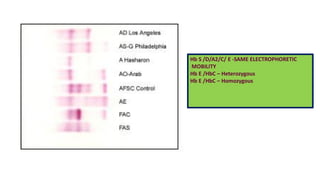 Hb S /D/A2/C/ E -SAME ELECTROPHORETIC
MOBILITY
Hb E /HbC – Heterozygous
Hb E /HbC – Homozygous
 