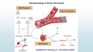 Pathophysiology of Sickle Cell Anemia
(Modified from Steinberg, M., Cecil Medicine 2007)
HbS Polymer
Vaso-occlusion
Hemolysis
Arginine NO
 