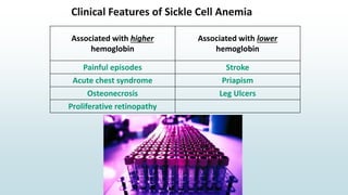 Clinical Features of Sickle Cell Anemia
Associated with higher
hemoglobin
Associated with lower
hemoglobin
Painful episodes Stroke
Acute chest syndrome Priapism
Osteonecrosis Leg Ulcers
Proliferative retinopathy
 