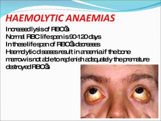 Increased lysis of RBC’s Normal RBC life span is 90-120 days In these life span of RBC’s decreases Haemolytic diseases result in anaemia if the bone marrow is not able to replenish adequately the premature destroyed RBC’s 