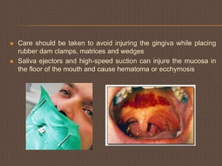  Care should be taken to avoid injuring the gingiva while placing
rubber dam clamps, matrices and wedges
 Saliva ejectors and high-speed suction can injure the mucosa in
the floor of the mouth and cause hematoma or ecchymosis
 
