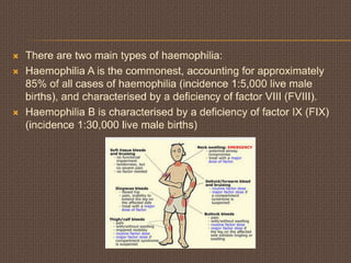  There are two main types of haemophilia:
 Haemophilia A is the commonest, accounting for approximately
85% of all cases of haemophilia (incidence 1:5,000 live male
births), and characterised by a deficiency of factor VIII (FVIII).
 Haemophilia B is characterised by a deficiency of factor IX (FIX)
(incidence 1:30,000 live male births)
 