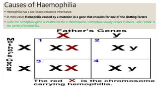 Causes of Haemophilia
 Hemophilia has a sex-linked recessive inheritance.
 In most cases Hemophilia caused by a mutation in a gene that encodes for one of the clotting factors
 Since the hemophilia gene is located on the X chromosome, Hemophilia usually occurs in males, and Female is
the carrier of hemophilia.
 